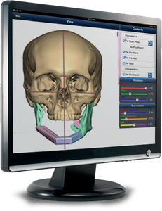 Virtual Surgical Planning Product Image