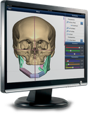 Virtual Surgical Planning Product Image