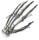 Hand Fusion System Product Image