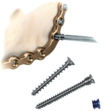 Mandibular Fracture Reconstruction System Product Image