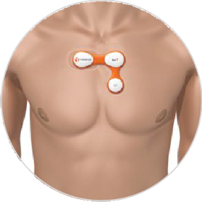 Peerbridge Wireless ECG  Product Image