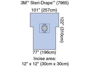 Steri-Drape™ Cesarean-Section Sheets and Pouches Product Image