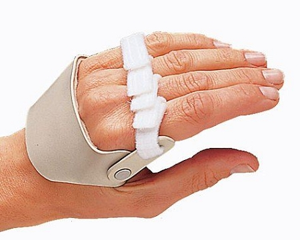 Radial Hinged Ulnar Deviation Arthritis Splints Product Image