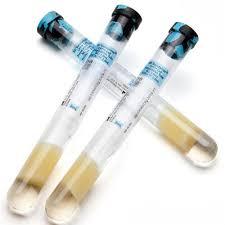 BD VACUTAINER® MONONUCLEAR CELL PREPARATION TUBE (CPT™) Product Image