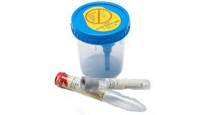 Vacutainer® Urine Collection System Product Image