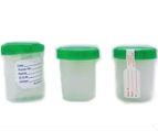 GMAX Stool Specimen Container Product Image